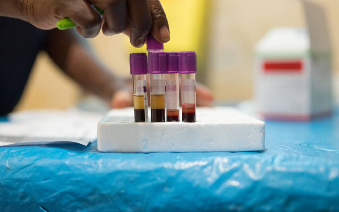 With a Comprehensive Program, ICAP Works to Strengthen Advanced HIV Disease Screening and Management in Zambia’s Northwestern Province