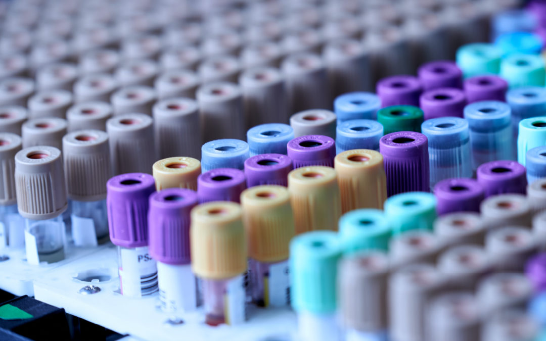 (ABC News Online) Jessica Justman Explains the Limitations of Antibody Testing Technologies as New COVID-19 Variants Emerge