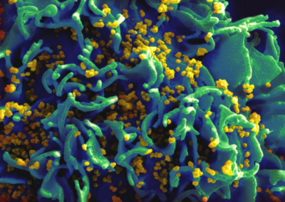 ICAP to Test New Combinations of Antibodies for HIV Prevention